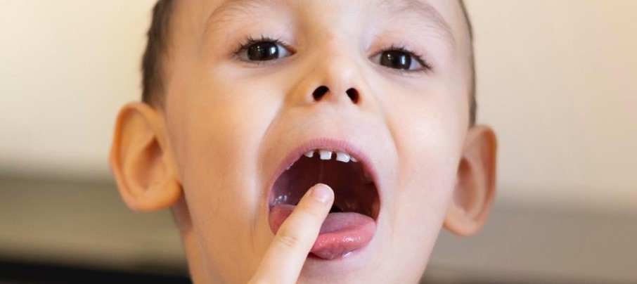 María Uribe Logopeda - Terapia Miofuncional